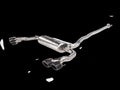 Akrapovic 2024+ Mercedes-AMG CLA 45 / CLA 45 S (C118/x118) Evo Line Cat Back Titanium with CF Tips - S-ME/T/6H